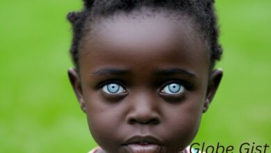 can black people have blue eyes?