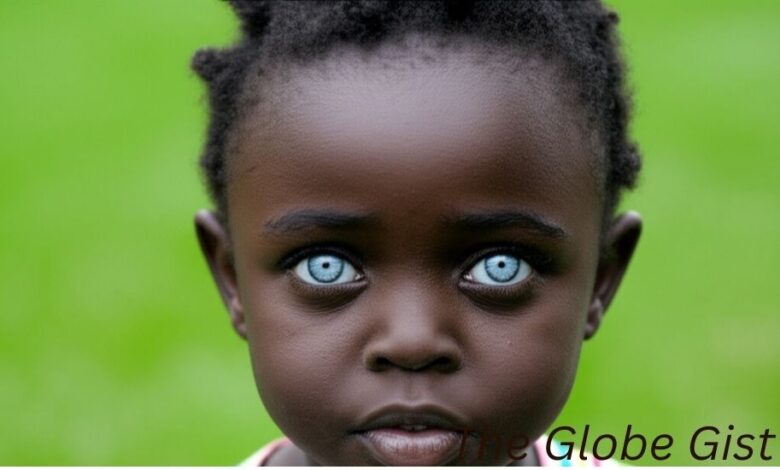 can black people have blue eyes?